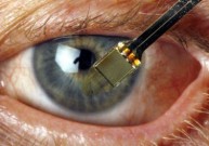 Implantuojamos biosintetinės ragenos gali regeneruoti natūralų akies audinį