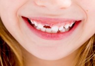 Už išsaugotus sveikus dantis užaugę Jūsų vaikai Jums padėkos