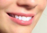 Estetinis dantų plombavimas ir jo privalumai