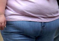 Nutukę žmonės patiria "sunkią smegenų degeneraciją"