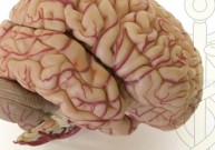 Vietoj smegenų auglio gydytojai moters galvoje rado kirminą