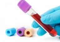 Kraujo tyrimai Klaipėdoje: kaip pasirinkti kliniką?