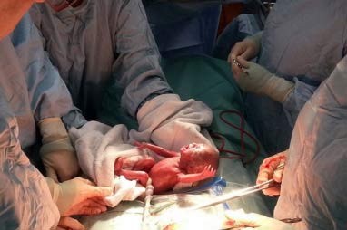 Aborto metu gimę gyvi kūdikiai nesusilaukia jokios pagalbos iš Europos Tarybos