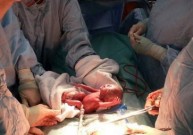 Aborto metu gimę gyvi kūdikiai nesusilaukia jokios pagalbos iš Europos Tarybos