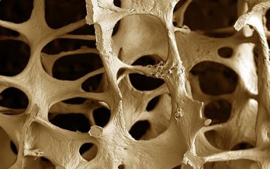 Vitaminas D apsaugo nuo osteoporozės