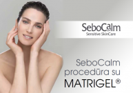 SeboCalm procedūra su MATRIGEL®