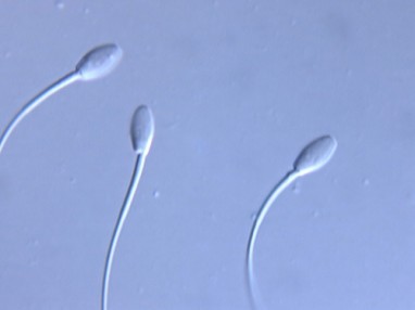 Spermos donorą galima rinktis ir pagal aprangos stilių