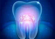 Dantų šaknų kanalų beskausmis gydymas ir pergydymas