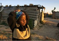 PSO: Zimbabvėje cholera serga beveik 63 tūkst. žmonių
