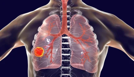 Ketvirtadalis britų vėžį sieja su likimu