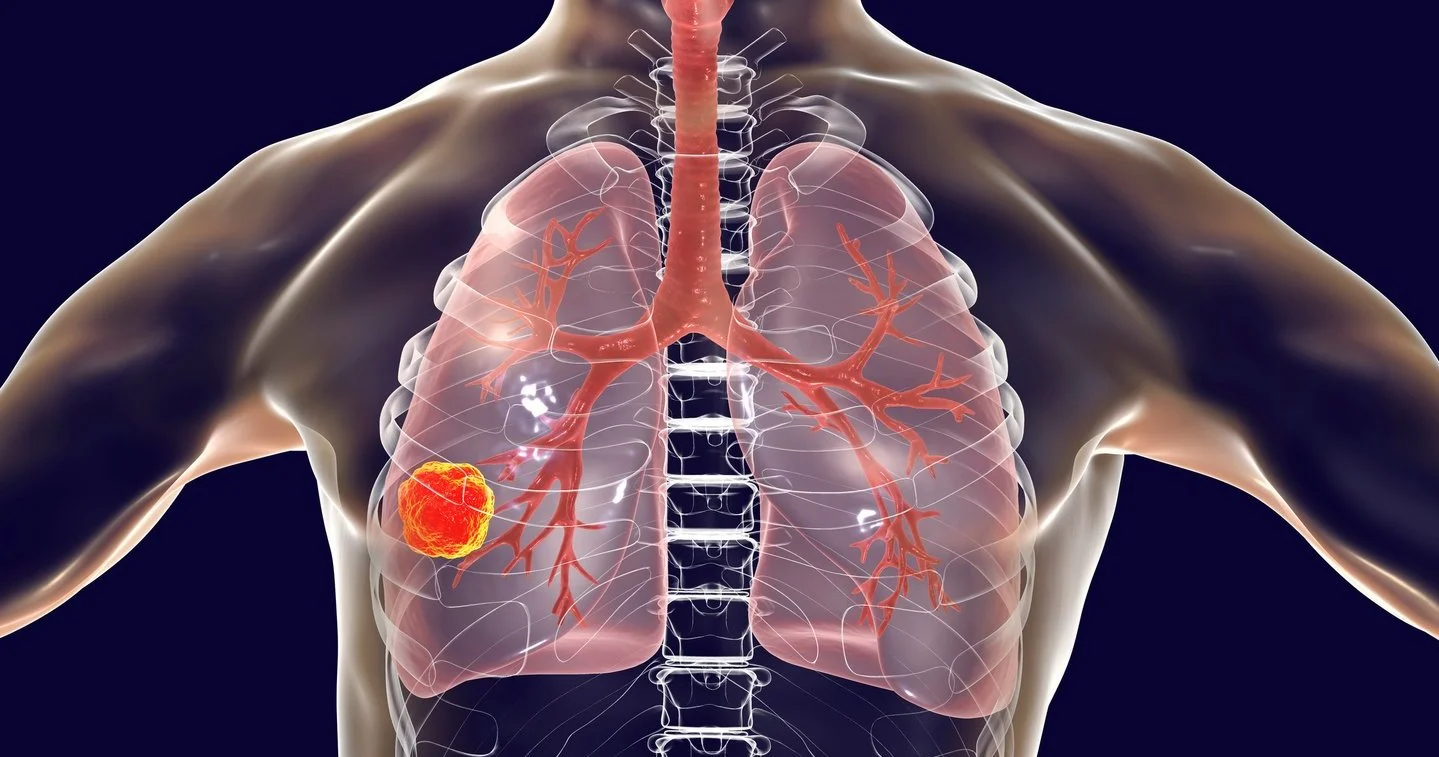 Ketvirtadalis britų vėžį sieja su likimu
