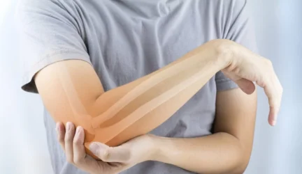 Gimusiems mažesnio svorio didesnė osteoporozės tikimybė vyresniame amžiuje