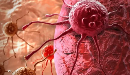 Gėrybinis auglys užaugo tiek svorio, kiek sveria pati pacientė