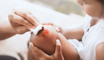 Mirties priežastimi dažnai tampa netinkama žaizdų priežiūra