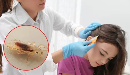 Ką daryti, jei vaiką apniko utėlės?