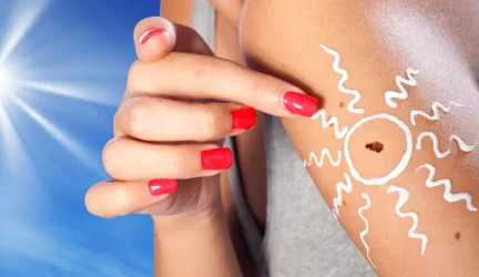 Melanomą sukelia besaikis kaitinimasis saulėje