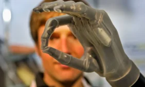 Bioniniai protezai žmonėms dovanoja įprastinio gyvenimo galimybes