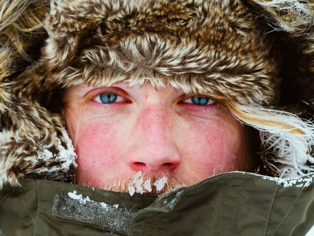 Šalčio dilgėlinė – sunkiai įveikiama bėda