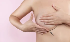 Chirurgas per klaidą moteriai amputavo sveiką krūtį