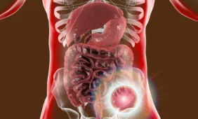 Sportas sumažina gaubtinės žarnos vėžio rizika