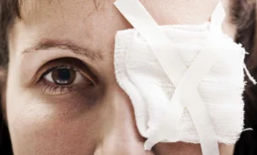 Akies traumas padės gydyti kontaktiniai lęšiai su kamieninėmis ląstelėmis