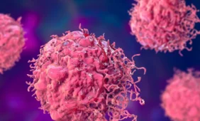 Išrastas naujas metastazių gydymo būdas