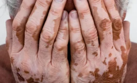 Nemalonių konsultacijų baimę įveikia sunkios ligos grėsmė