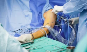 Peties operacijos – tobulumo link