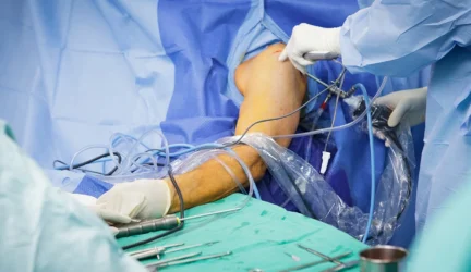 Peties operacijos – tobulumo link