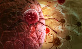 Vėžiui stabdyti – ankstyva diagnozė