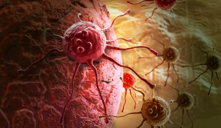 Vėžiui stabdyti – ankstyva diagnozė