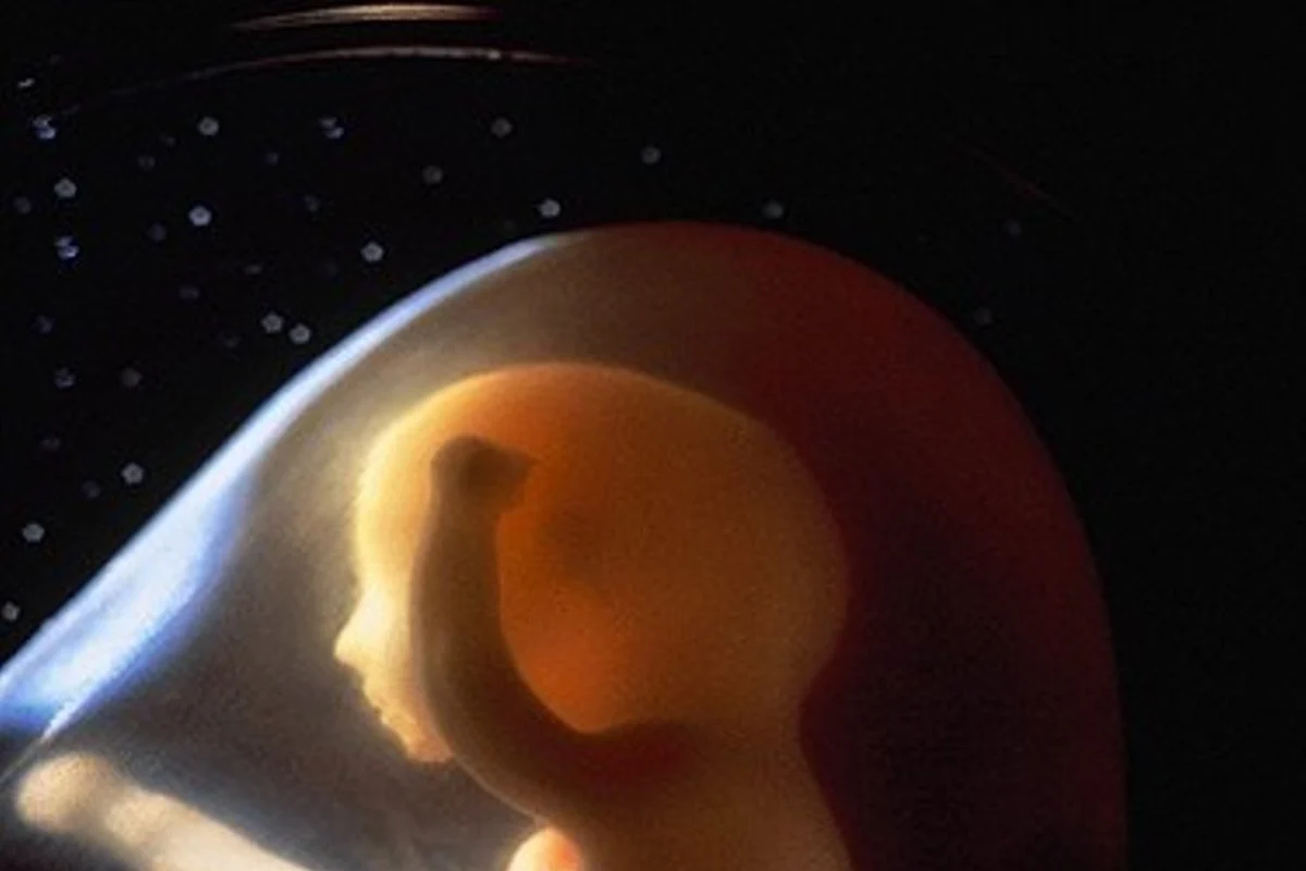 Lenkijoje rekordiškai padaugėjo legalių abortų