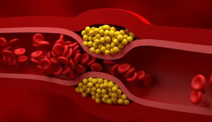 Cholesterolis – draugas ar priešas?