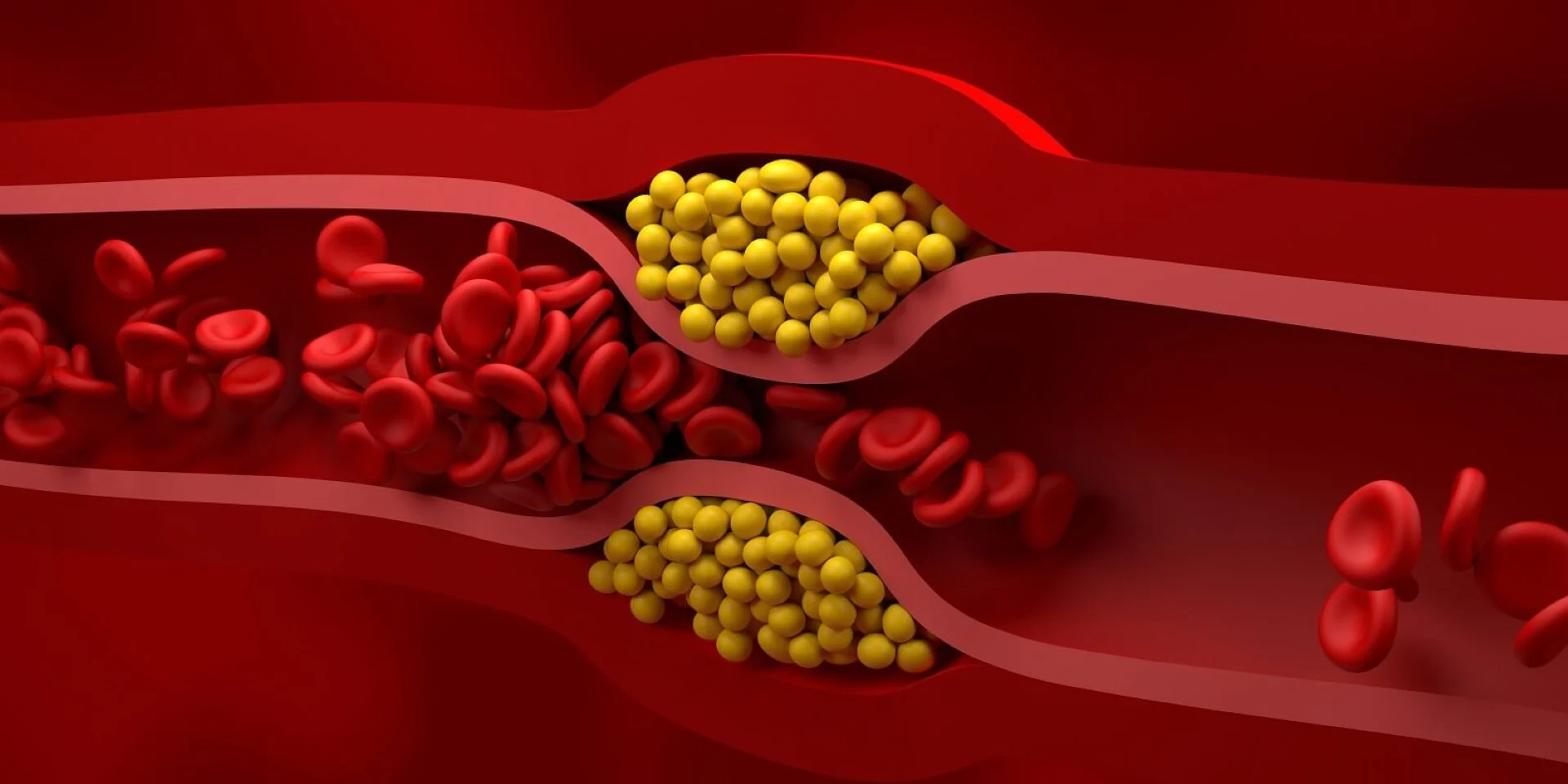 Cholesterolis – draugas ar priešas?