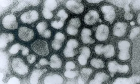 Informacija gyventojams dėl gripo viruso A(H1N1)