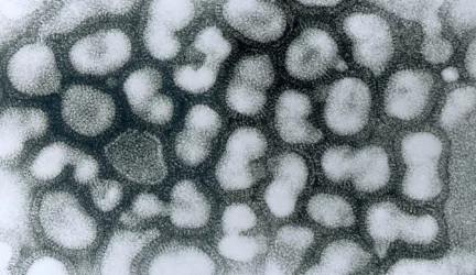 Informacija gyventojams dėl gripo viruso A(H1N1)