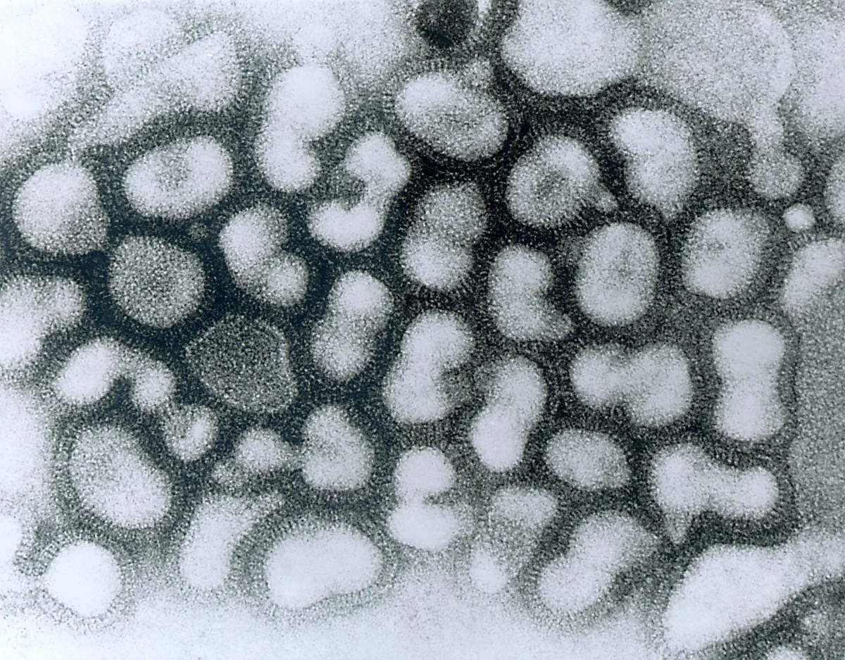 Informacija gyventojams dėl gripo viruso A(H1N1)