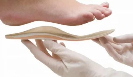 Plokščiapadžius nuo skausmų išvaduos implantas