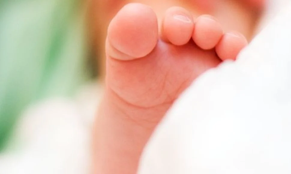 Šiaulių ligoninėje nudegę kūdikiai pervežami į Kauną