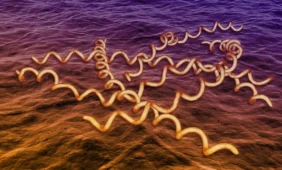 Sifilį Europai dovanojo Kolumbas