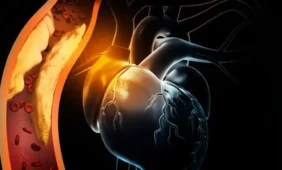 Širdies ligų priežastis – per kelias sekundes