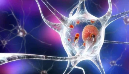 Parkinsono ligą gali įveikti neurostimuliacija