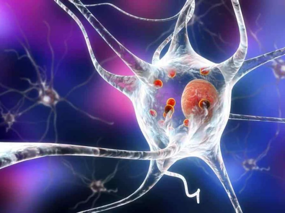 Parkinsono ligą gali įveikti neurostimuliacija