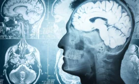 Smegenų parazitus degins aukso nanodalelės ir lazeriai