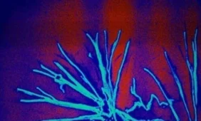 Sukurti žmogaus organizmą iš vidaus galintys gydyti nanorobotai