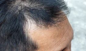 Atrastas plikimo genas