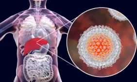 Gal tu esi tas 12-as numeris, sergantis hepatitu?