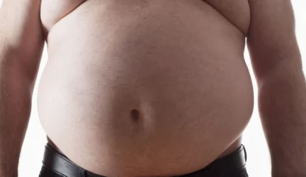 Išrasta nuo nutukimo sauganti piliulė