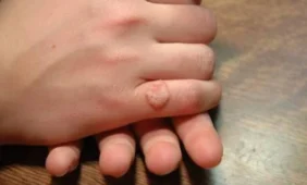 Karpos gali tapti skyrybų priežastimi