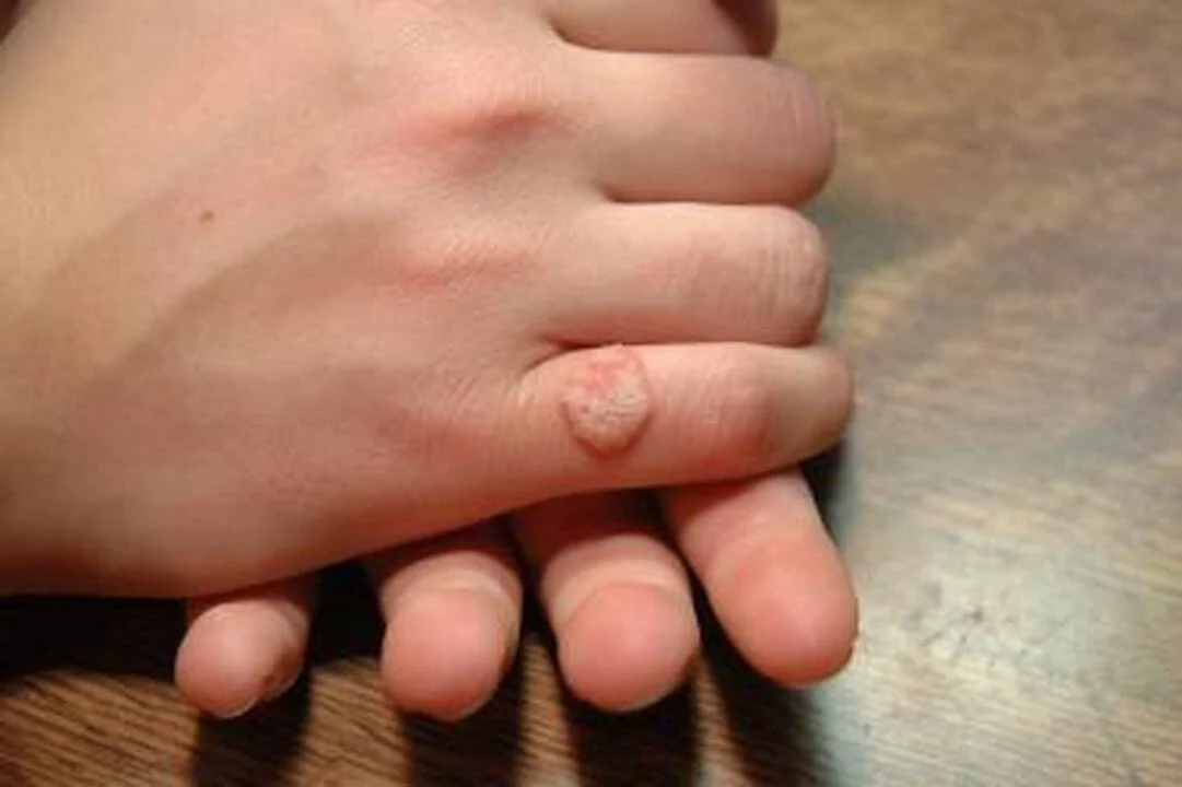 Karpos gali tapti skyrybų priežastimi